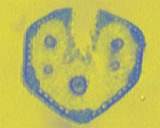 Clicker